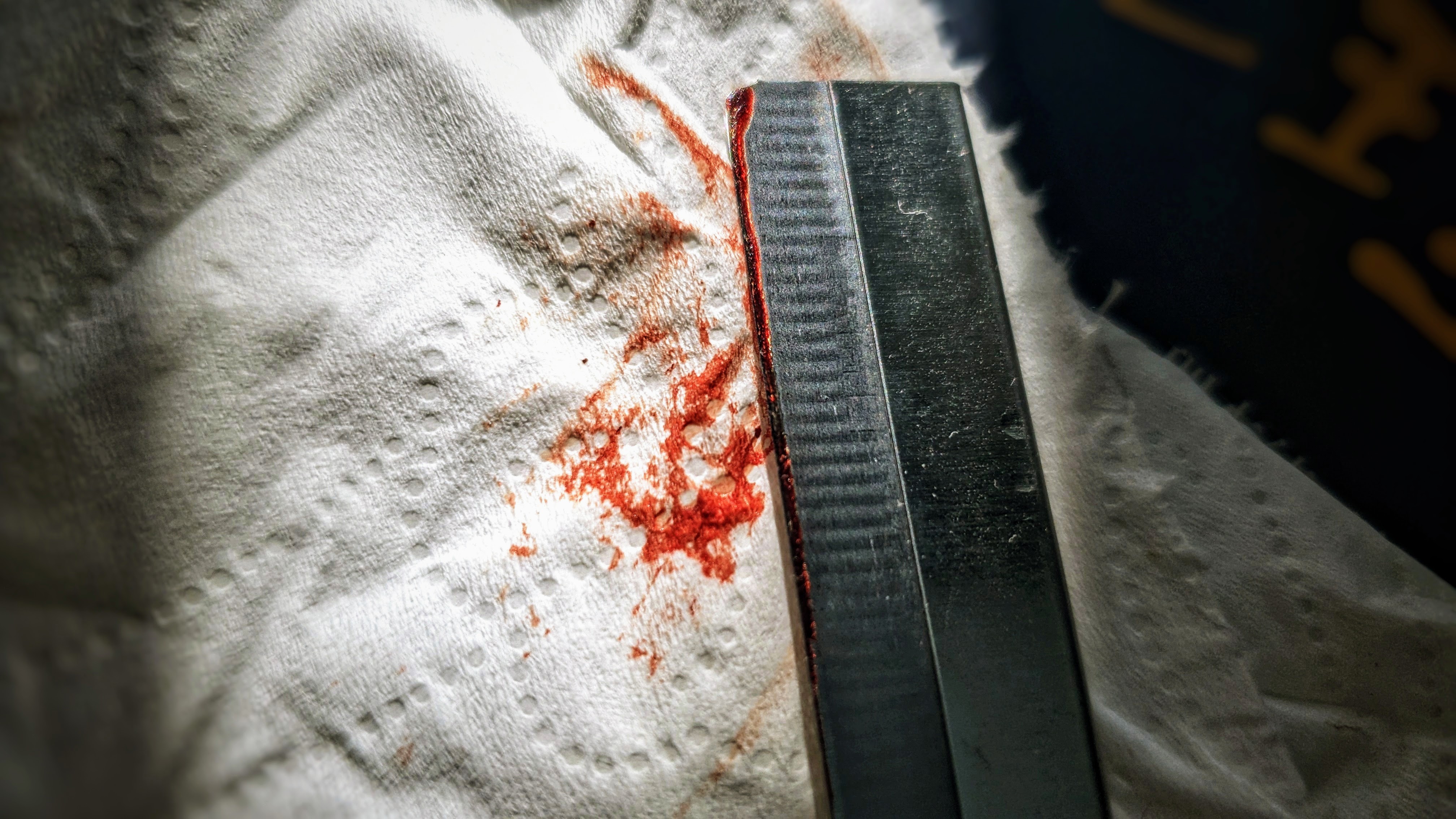 一些关于自伤的自助策略